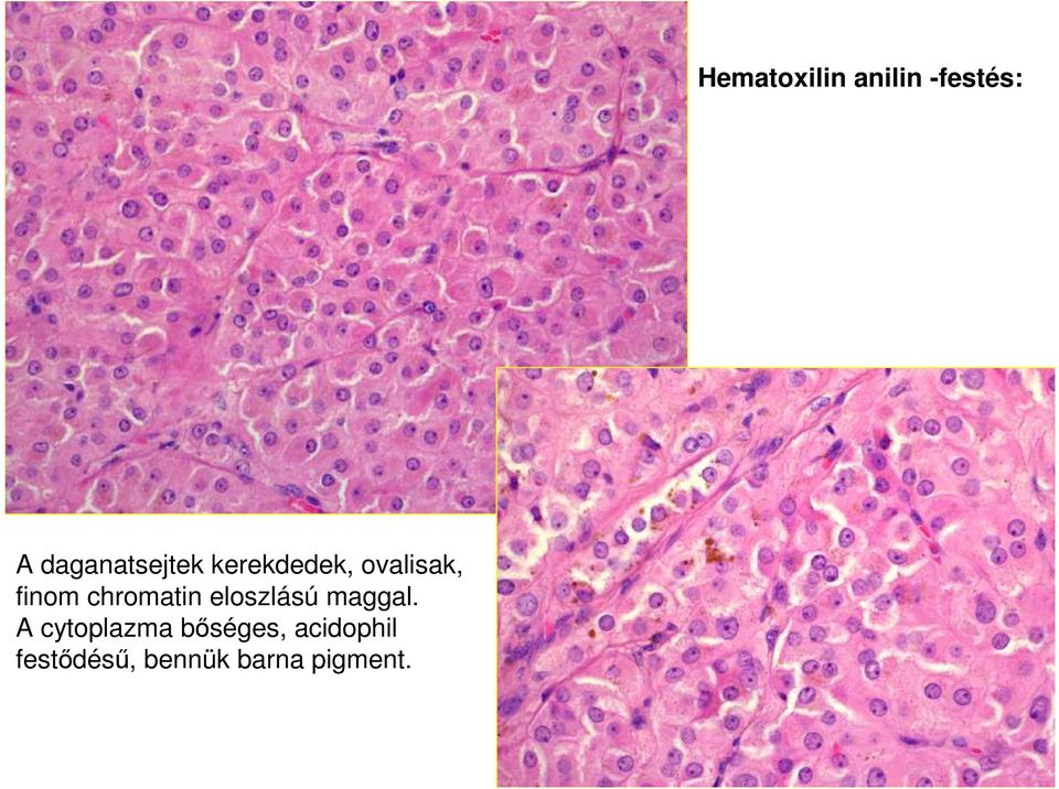 A cytoplazma bıséges, acidophil