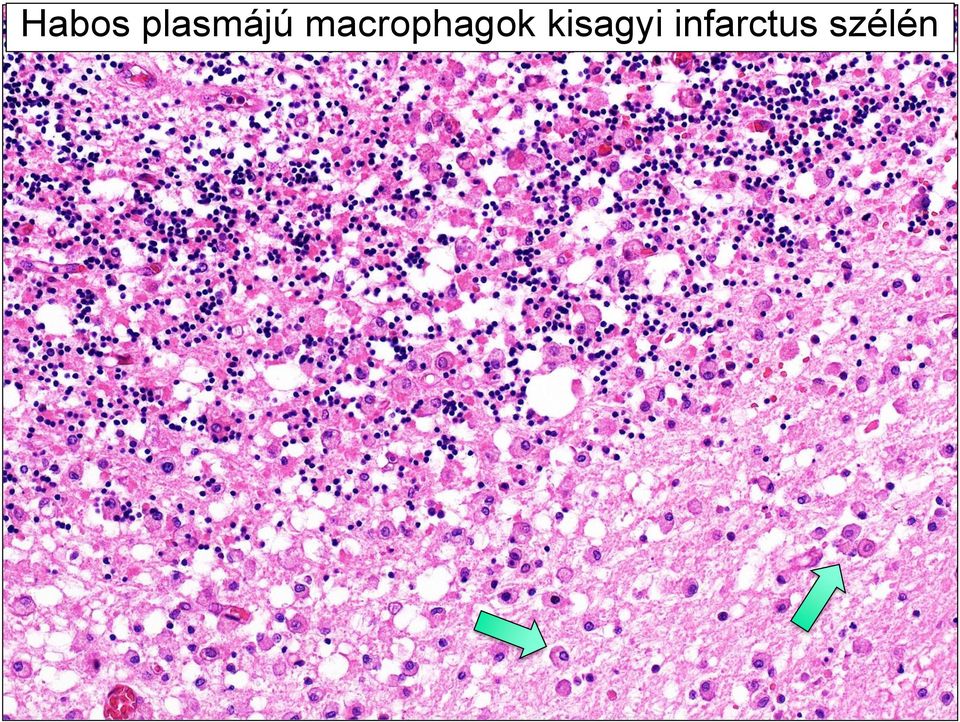 macrophagok