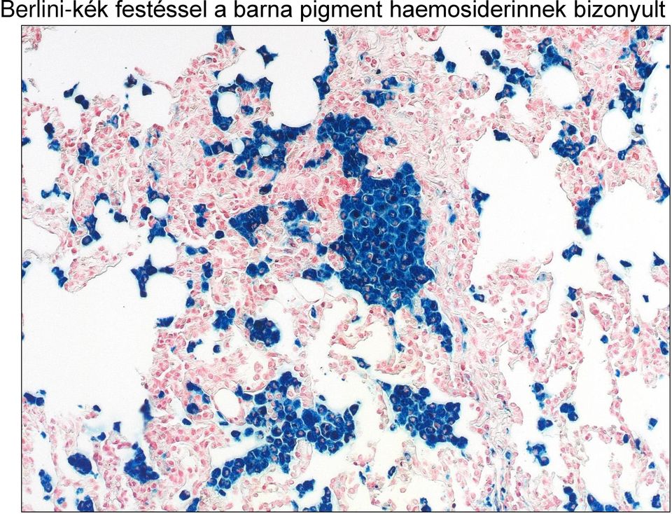 barna pigment