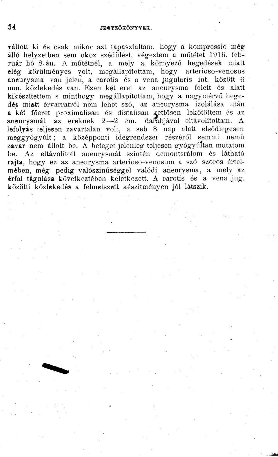 Ezen két eret az aneurysma felett és alatt kikészítettem s minthogj^ megállapítottam, hogy a nagymérvű hegedős miatt érvarratról nem lehet szó, az aneurysma izolálása után a, két főeret proximalisan