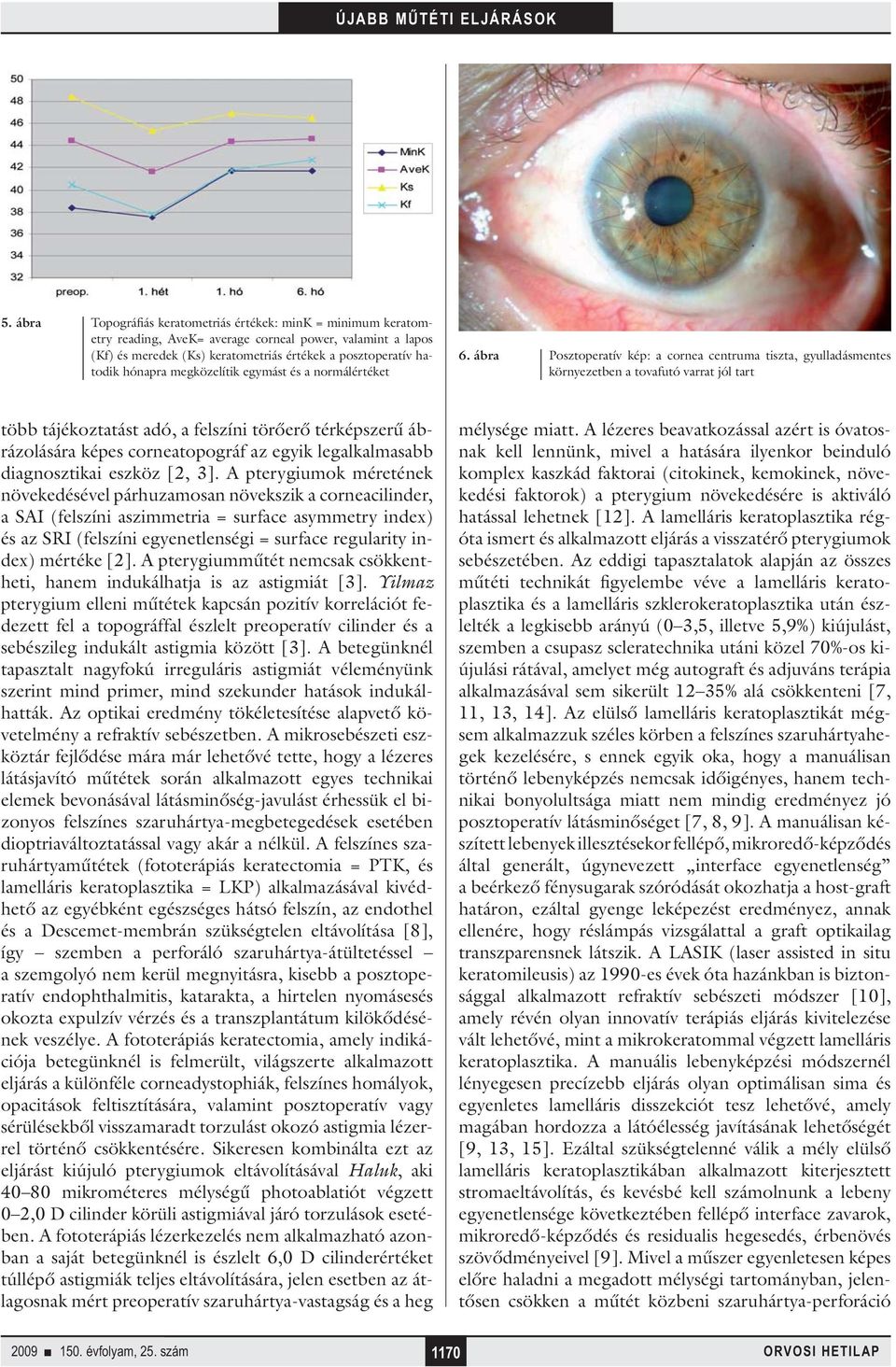 ábra Posztoperatív kép: a cornea centruma tiszta, gyulladásmentes környezetben a tovafutó varrat jól tart több tájékoztatást adó, a felszíni törőerő térképszerű ábrázolására képes corneatopográf az