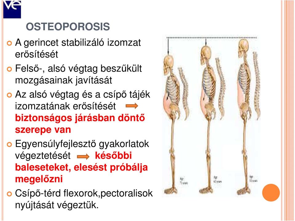 biztonságos járásban döntő szerepe van Egyensúlyfejlesztő gyakorlatok végeztetését