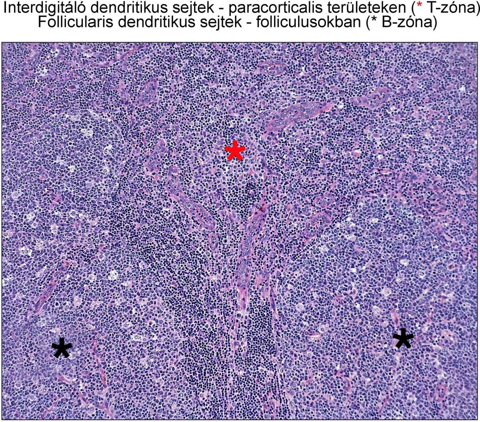 T-zóna) Follicularis dendritikus