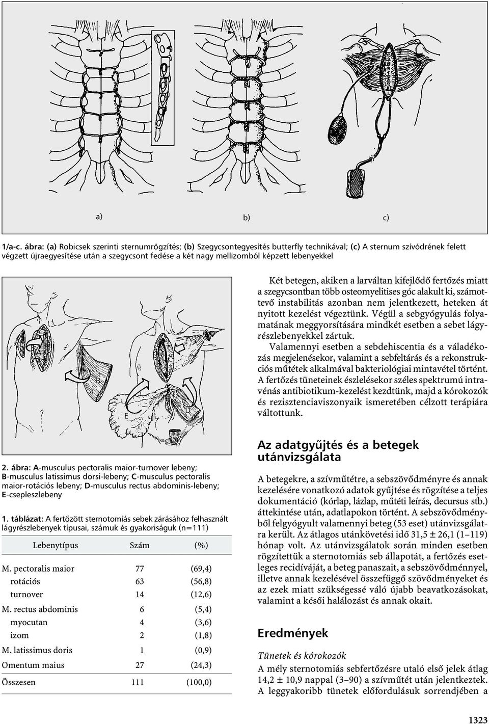 képzett lebenyekkel Két betegen, akiken a larváltan kifejlődő fertőzés miatt a szegycsontban több osteomyelitises góc alakult ki, számottevő instabilitás azonban nem jelentkezett, heteken át nyitott