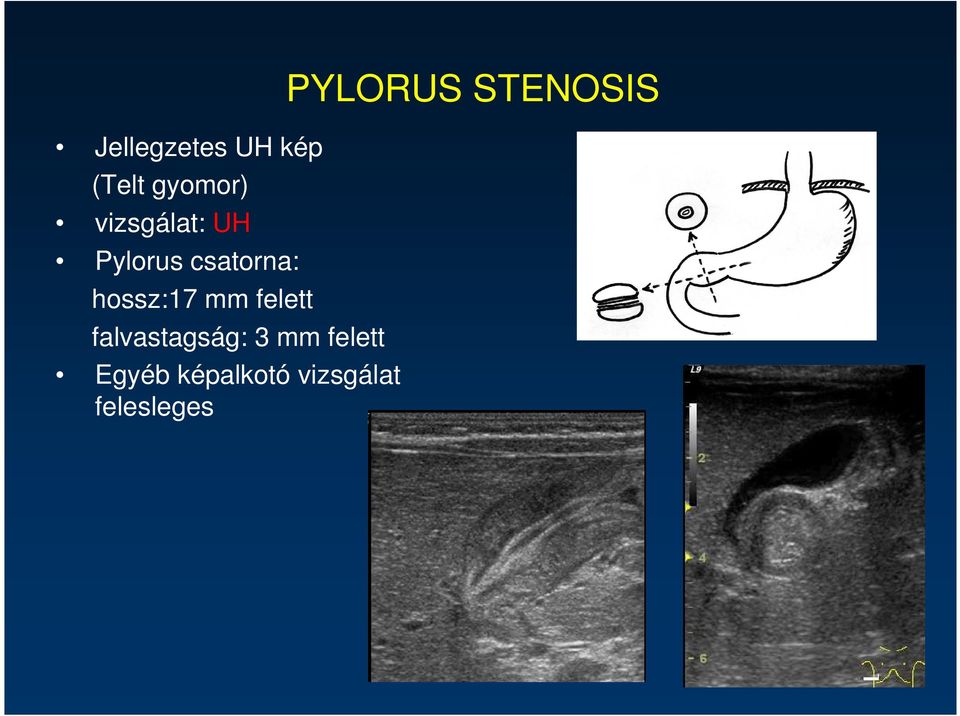 mm felett falvastagság: 3 mm felett