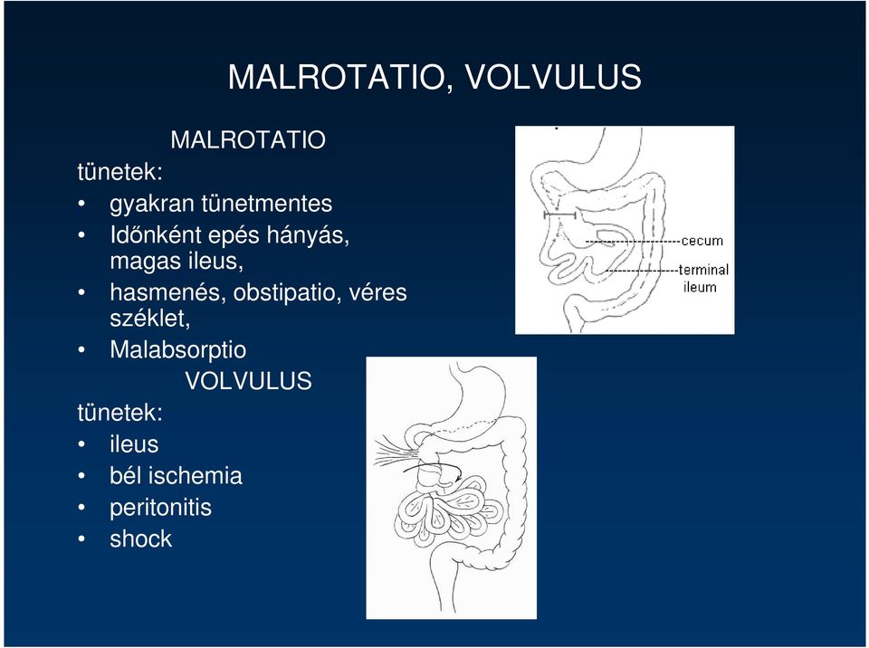 hasmenés, obstipatio, véres széklet, Malabsorptio