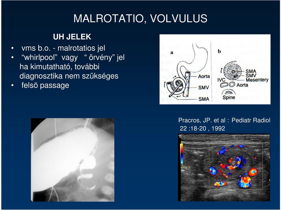 kimutatható, további diagnosztika nem szükséges