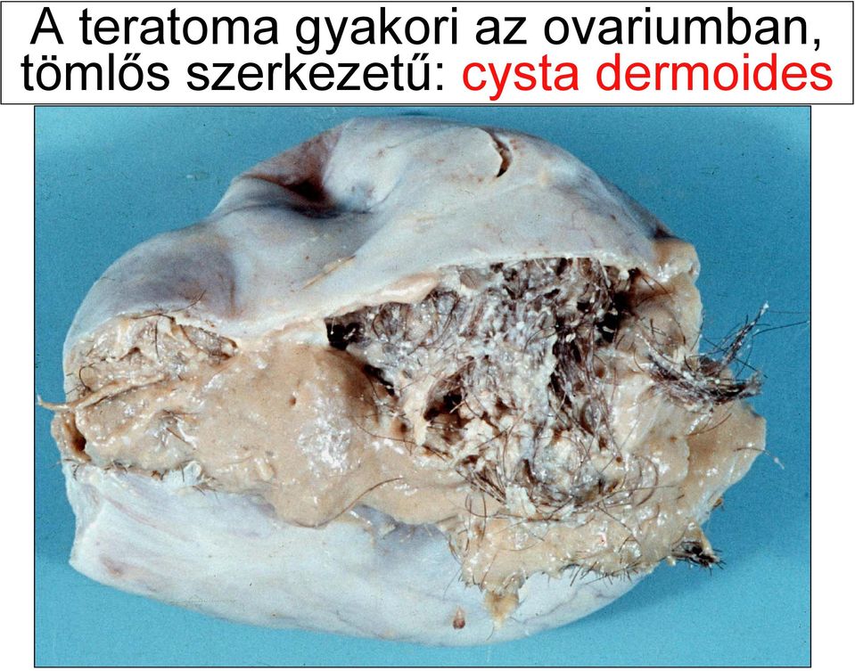 ovariumban,