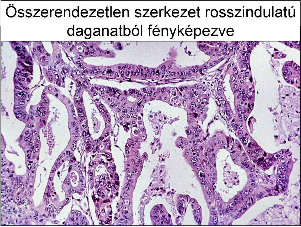 Összerendezetlen szerkezet