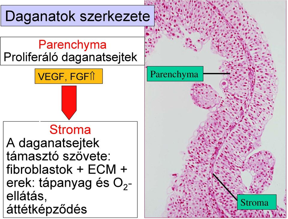 daganatsejtek támasztó szövete: fibroblastok +