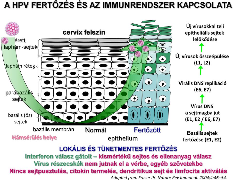 ..... Fertőzött epithelium Virális DNS replikáció (E6, E7) Vírus DNS a sejtmagba jut (E1, E2 / E6, E7) Bazális sejtek fertőzése (E1, E2) LOKÁLIS ÉS TÜNETMENTES FERTŐZÉS