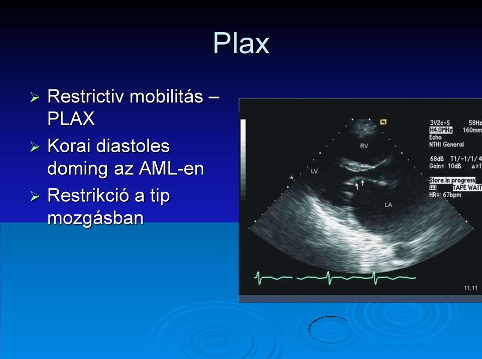 diastoles doming az