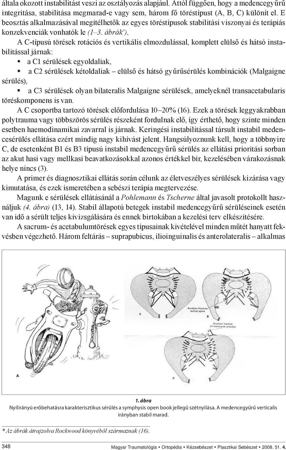 A C-típusú törések rotációs és vertikális elmozdulással, komplett elülső és hátsó instabilitással járnak: a C1 sérülések egyoldaliak, a C2 sérülések kétoldaliak elülső és hátsó gyűrűsérülés