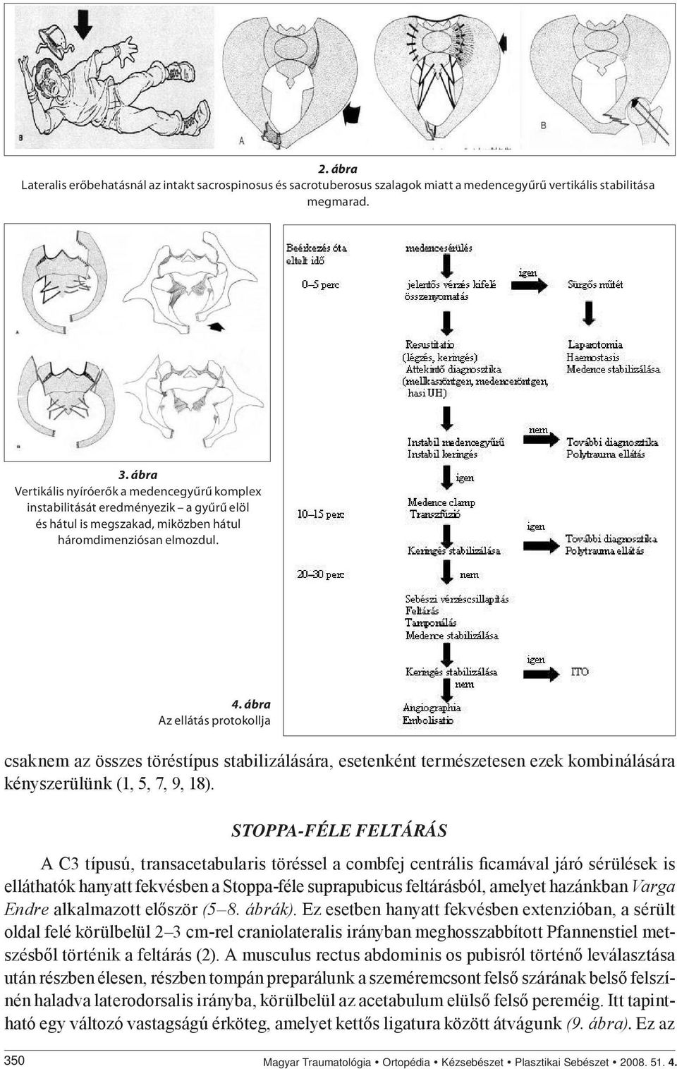 ábra Az ellátás protokollja csaknem az összes töréstípus stabilizálására, esetenként természetesen ezek kombinálására kényszerülünk (1, 5, 7, 9, 18).