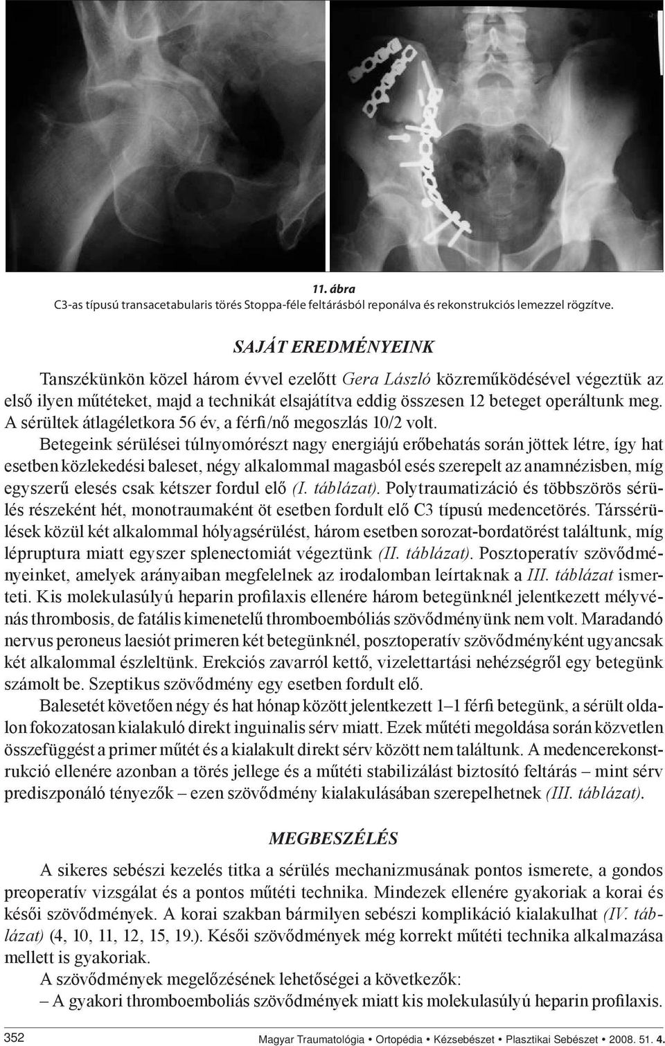 A sérültek átlagéletkora 56 év, a férfi/nő megoszlás 10/2 volt.