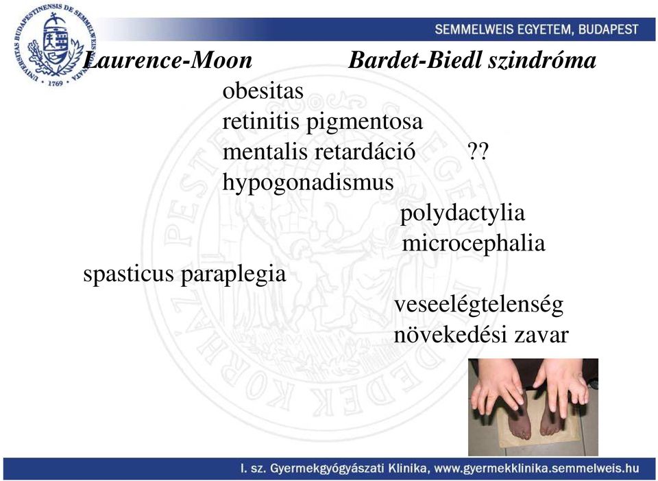 ? hypogonadismus polydactylia microcephalia