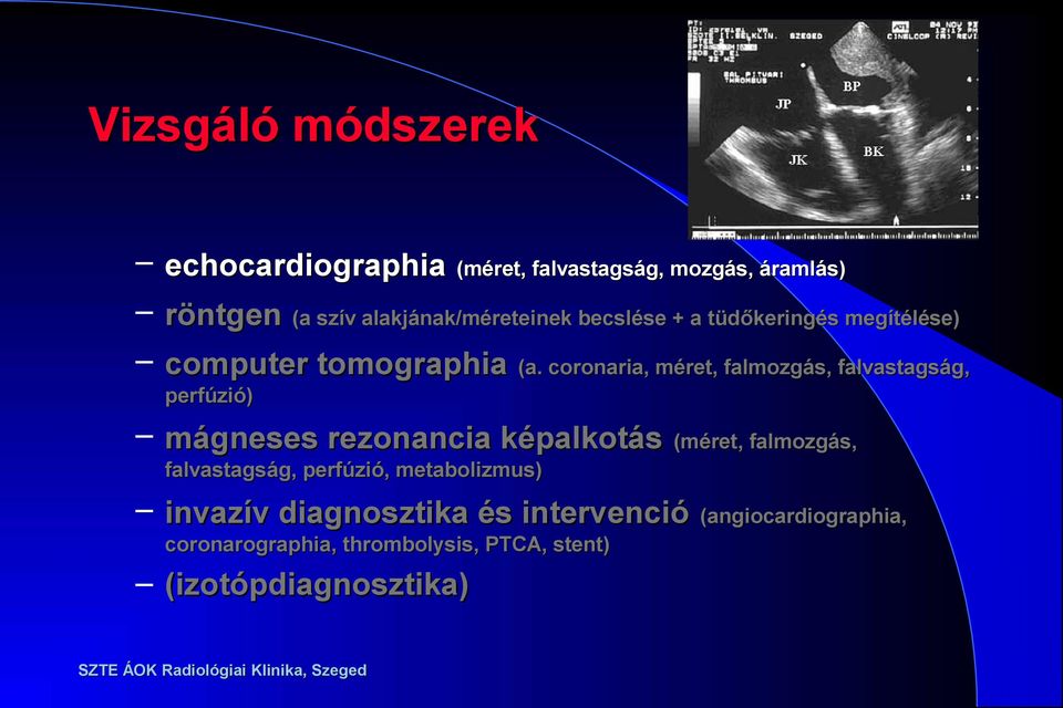 coronaria, méret, falmozgás, falvastagság, perfúzió) mágneses rezonancia képalkotás (méret, falmozgás,