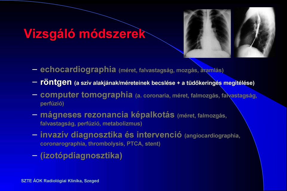 coronaria, méret, falmozgás, falvastagság, perfúzió) mágneses rezonancia képalkotás (méret, falmozgás,