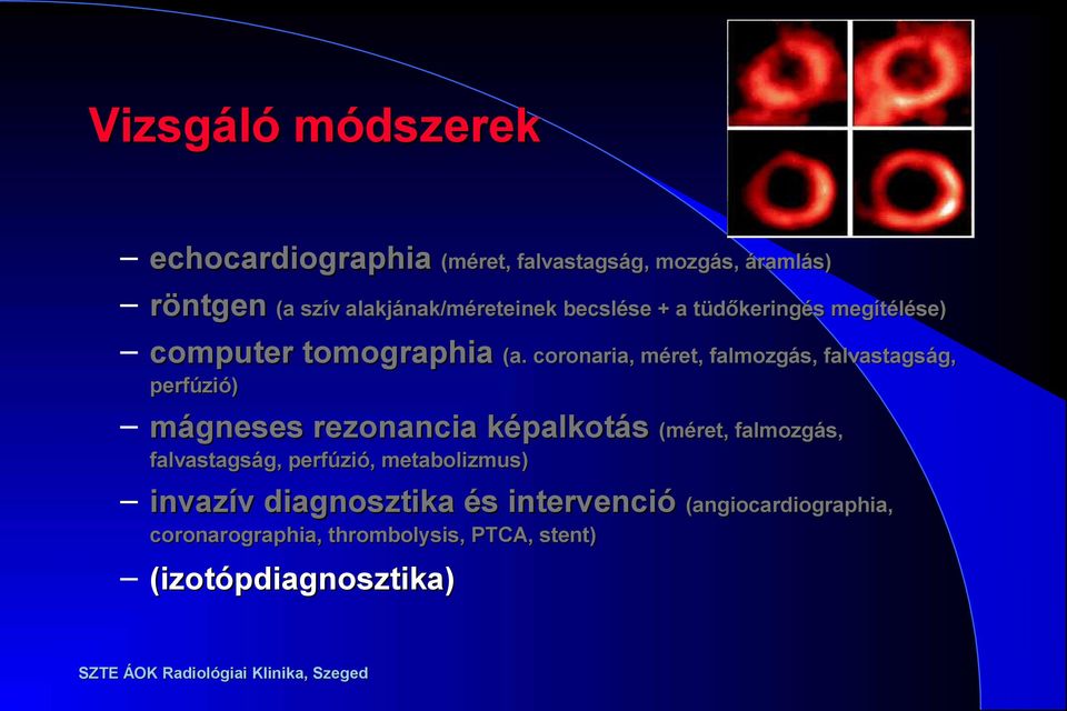 coronaria, méret, falmozgás, falvastagság, perfúzió) mágneses rezonancia képalkotás (méret, falmozgás,