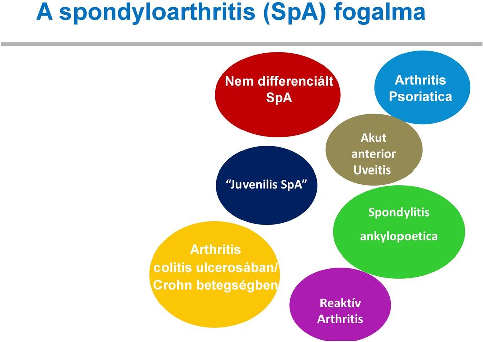 anterior Uveitis Spondylitis Arthritis colitis