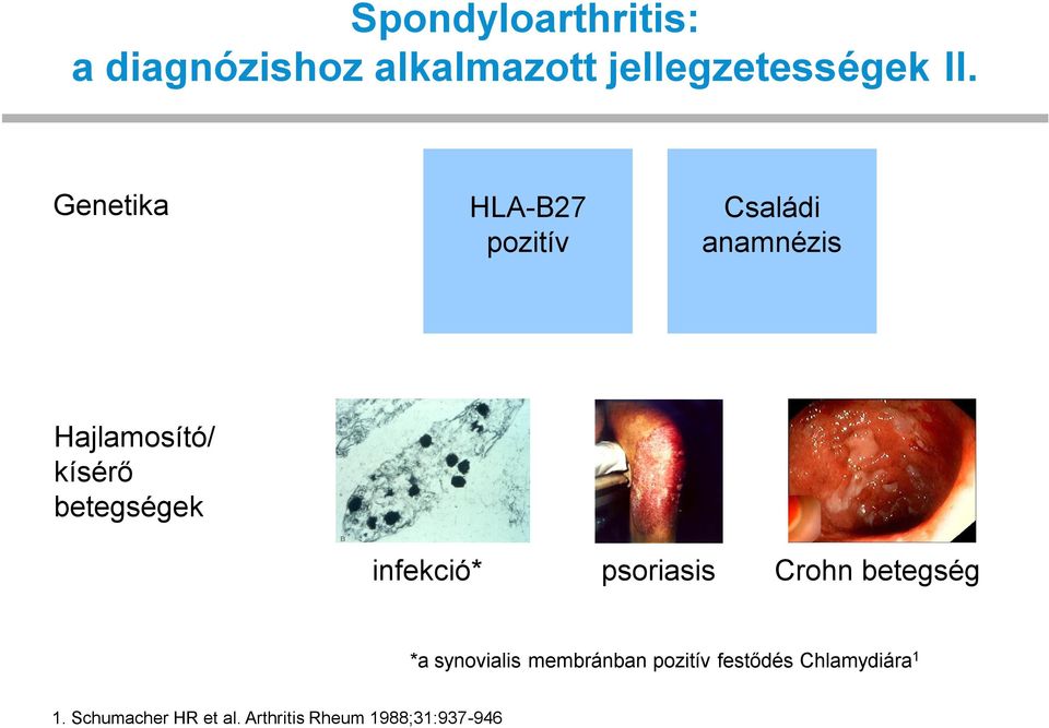 Genetika HLA-B27 pozitív Családi anamnézis Hajlamosító/ kísérő betegségek infekció*