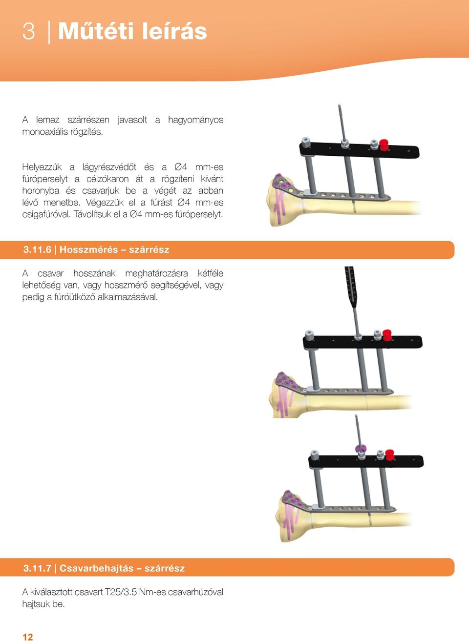 menetbe. Végezzük el a fúrást Ø4 mm-es csigafúróval. Távolítsuk el a Ø4 mm-es fúróperselyt. 3.11.