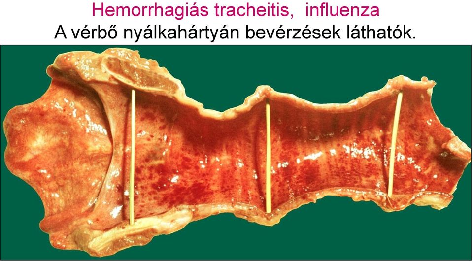 influenza A vérbő