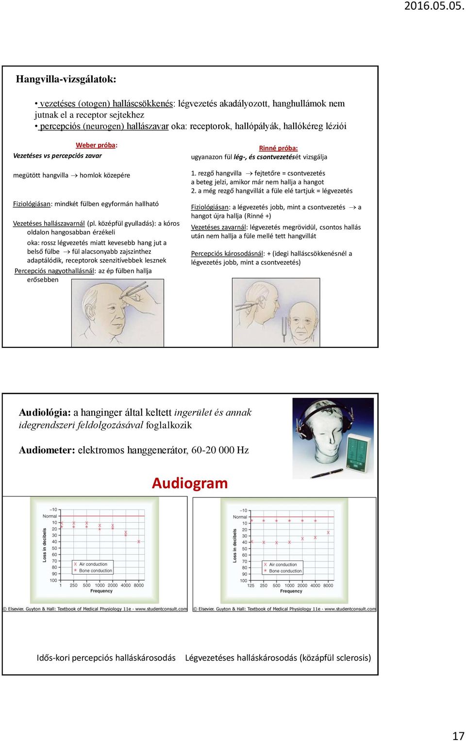 középfül gyulladás): a kóros oldalon hangosabban érzékeli oka: rossz légvezetés miatt kevesebb hang jut a belső fülbe fül alacsonyabb zajszinthez adaptálódik, receptorok szenzitívebbek lesznek