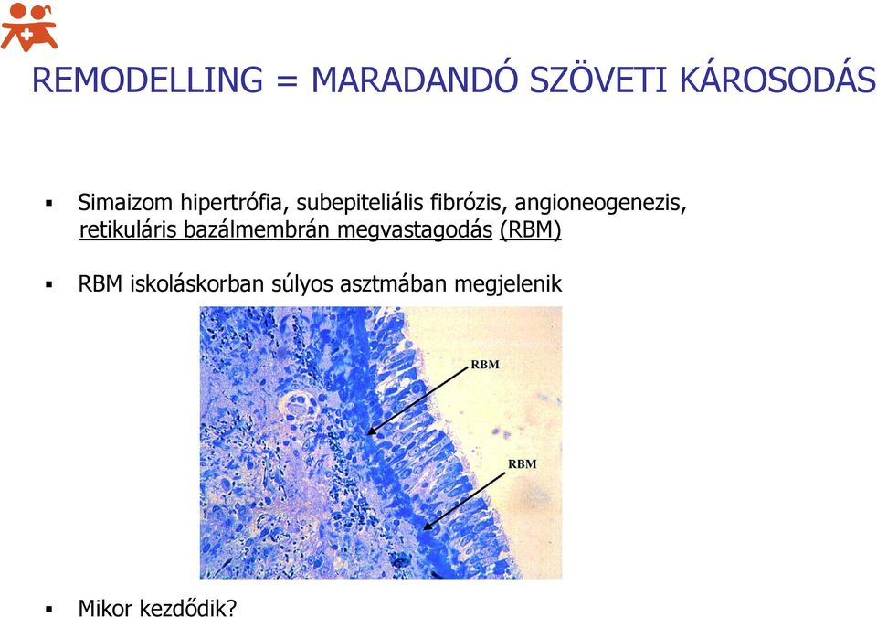 angioneogenezis, retikuláris bazálmembrán