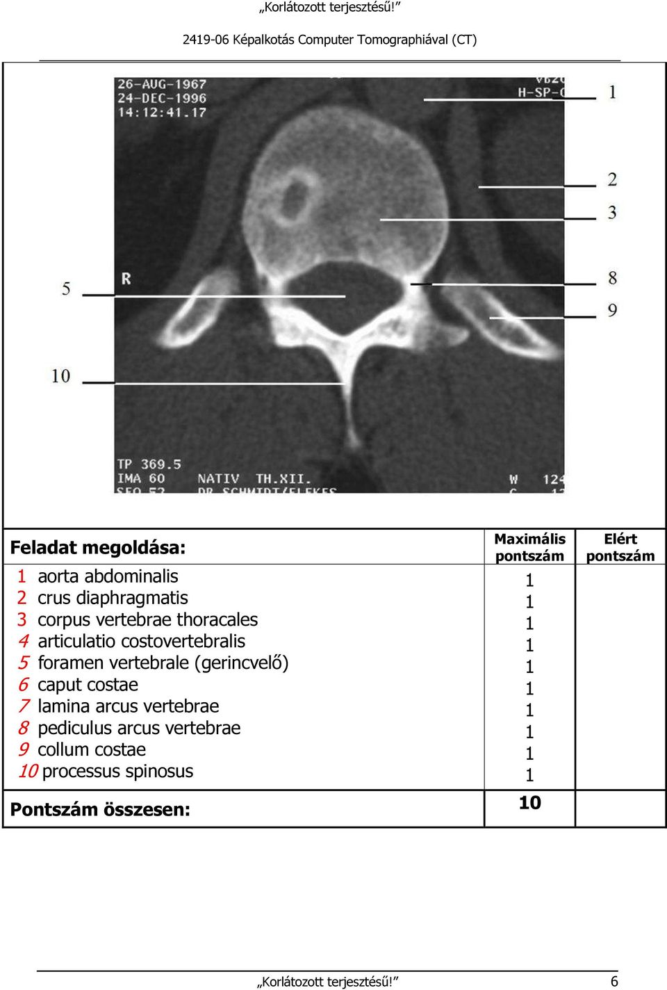 vertebrale (gerincvelő) 6 caput costae 7 lamina arcus vertebrae 8 pediculus arcus vertebrae