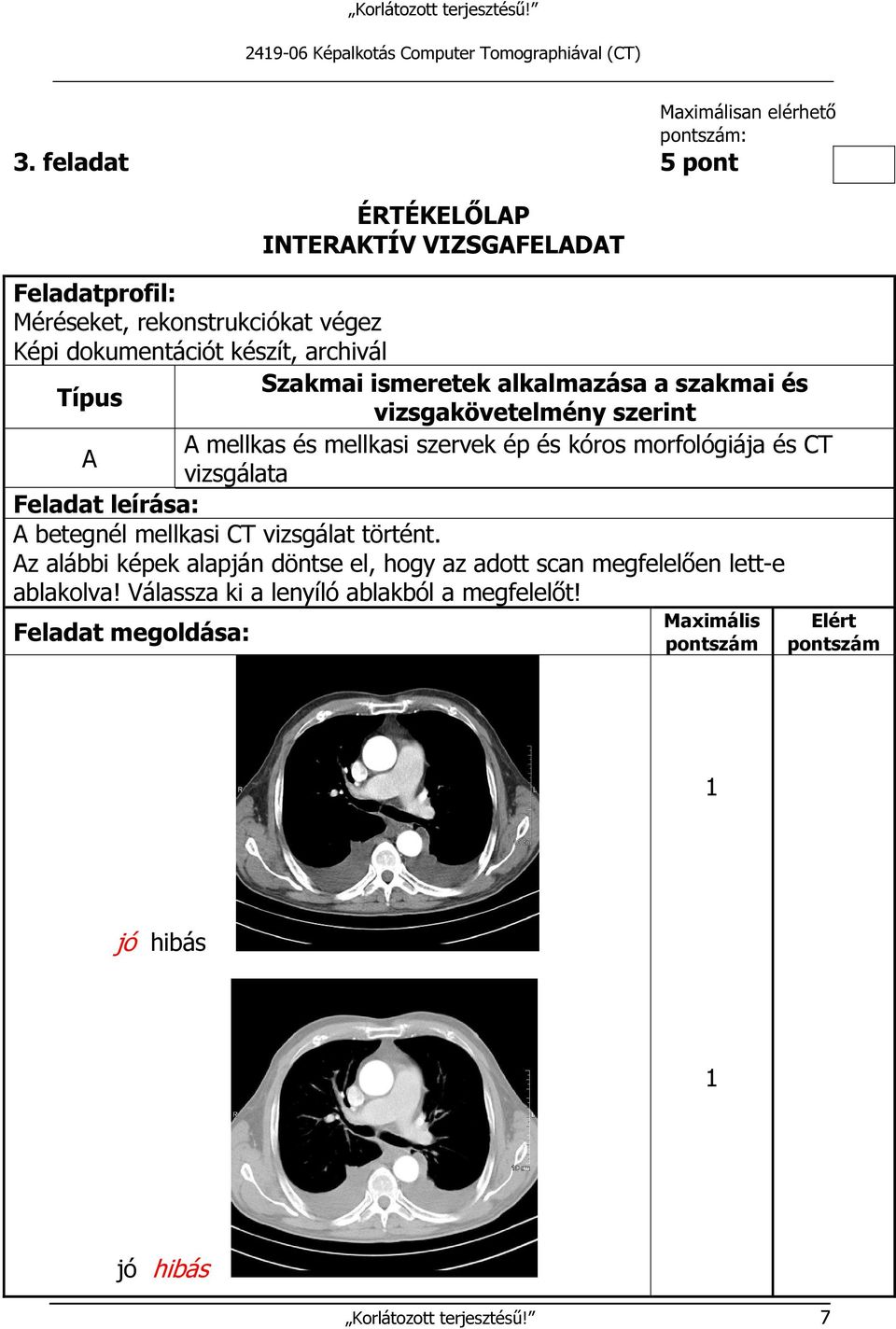 alkalmazása a szakmai és Típus vizsgakövetelmény szerint A mellkas és mellkasi szervek ép és kóros morfológiája és CT A vizsgálata Feladat leírása: A