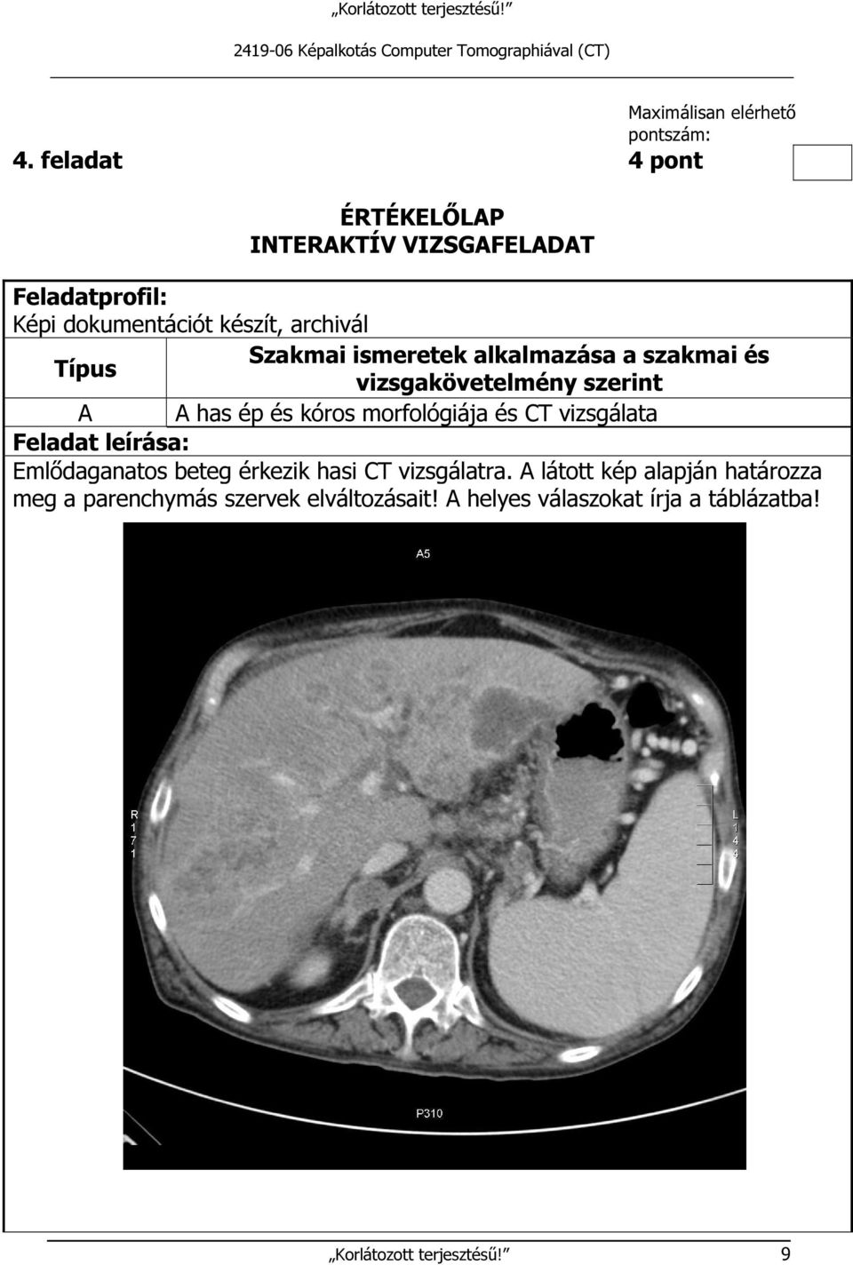 alkalmazása a szakmai és Típus vizsgakövetelmény szerint A A has ép és kóros morfológiája és CT vizsgálata Feladat leírása: