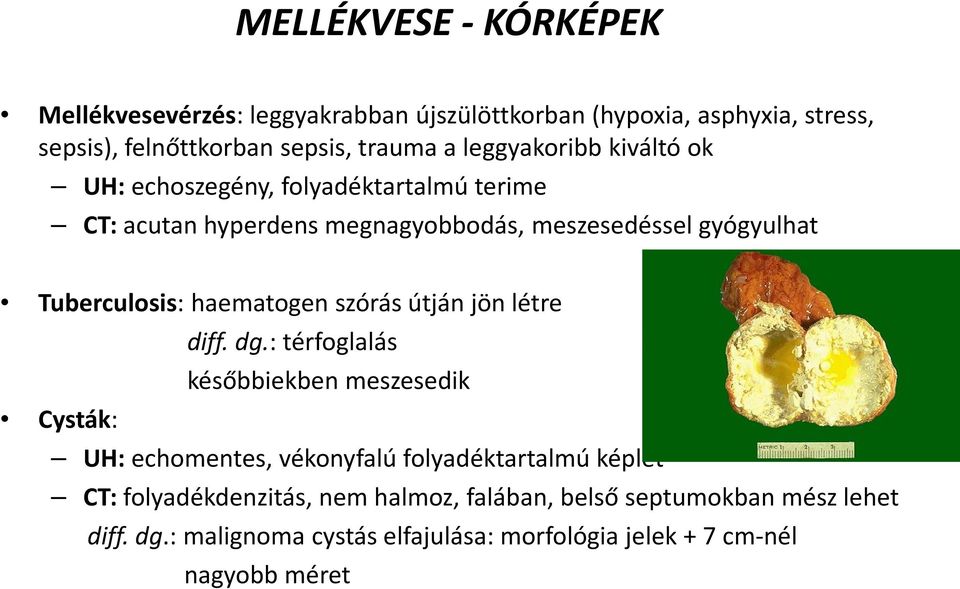 haematogen szórás útján jön létre diff. dg.