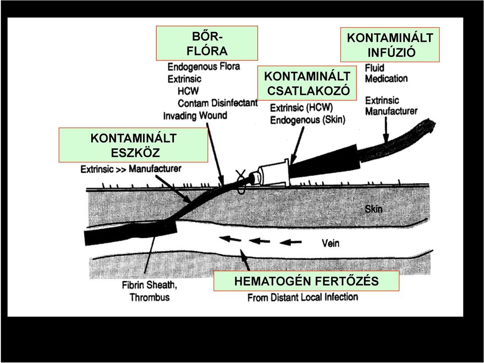 CSATLAKOZÓ KONTAMINÁLT