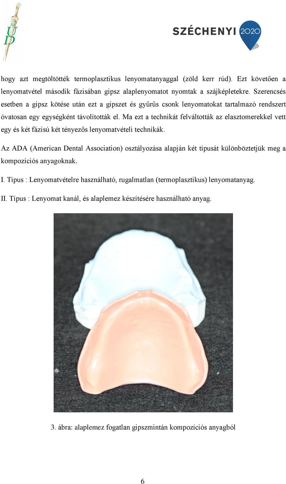 Ma ezt a technikát felváltották az elasztomerekkel vett egy és két fázisú két tényezős lenyomatvételi technikák.
