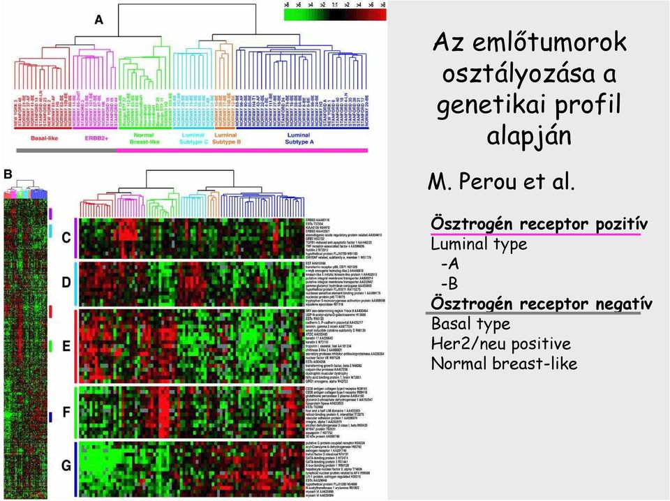 Ösztrogén receptor pozitív Luminal type -A -B