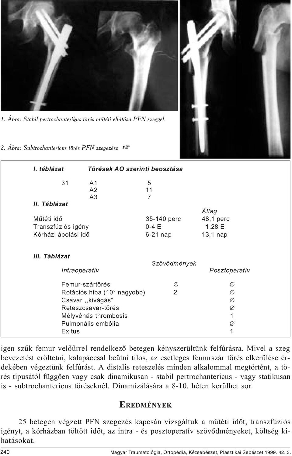 Táblázat Szövõdmények Intraoperatív Posztoperatív Femur-szártörés Rotációs hiba (10 nagyobb) 2 Csavar,,kivágás Reteszcsavar-törés Mélyvénás thrombosis 1 Pulmonális embólia Exitus 1 igen szûk femur