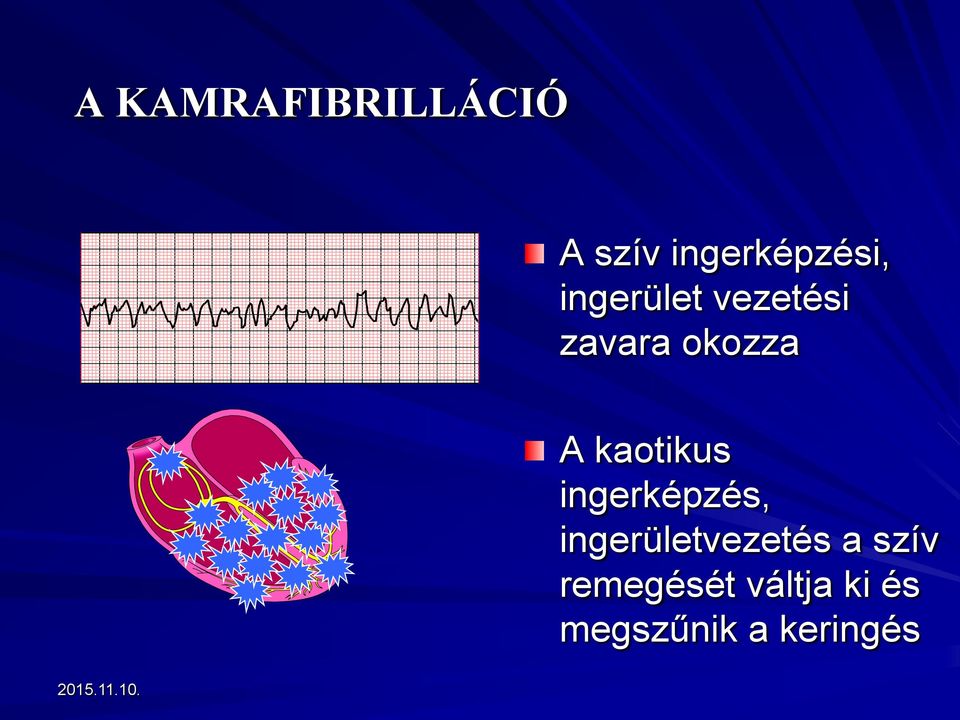 kaotikus ingerképzés, ingerületvezetés a