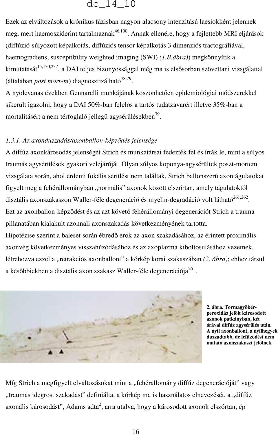 ábra)) megkönnyítik a kimutatását 15,130,237, a DAI teljes bizonyossággal még ma is elsısorban szövettani vizsgálattal (általában post mortem) diagnosztizálható 78,79.