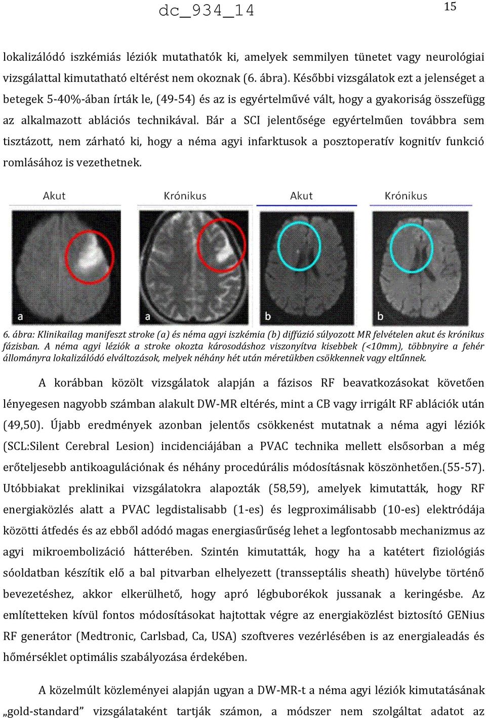 Bár a SCI jelentősége egyértelműen továbbra sem tisztázott, nem zárható ki, hogy a néma agyi infarktusok a posztoperatív kognitív funkció romlásához is vezethetnek. 6.