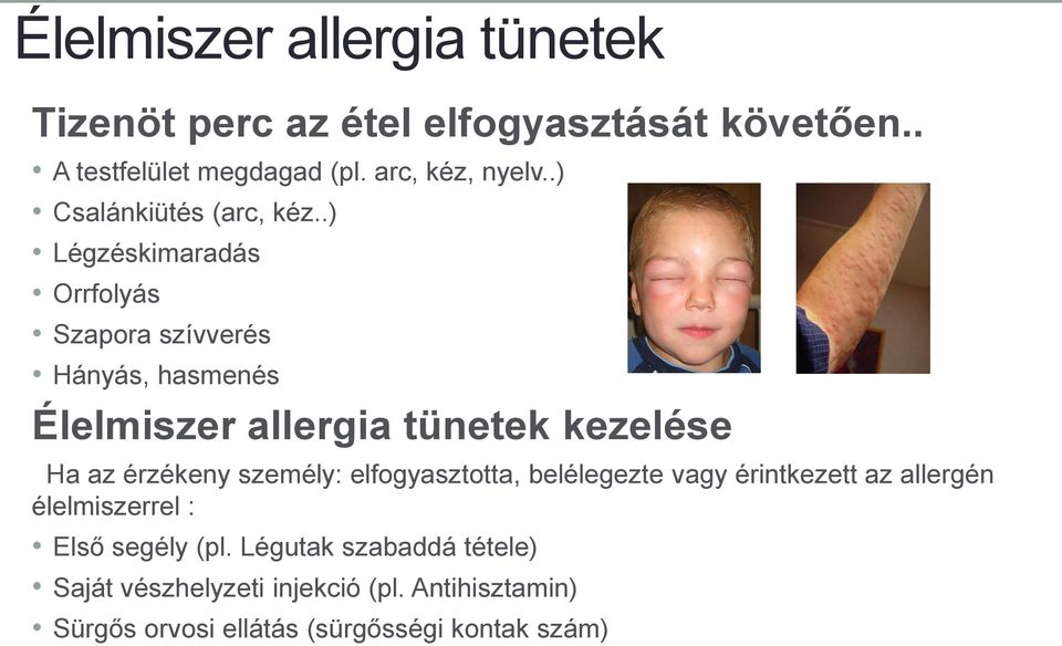 .) Légzéskimaradás Orrfolyás Szapora szívverés Hányás, hasmenés Élelmiszer allergia tünetek kezelése Ha az érzékeny