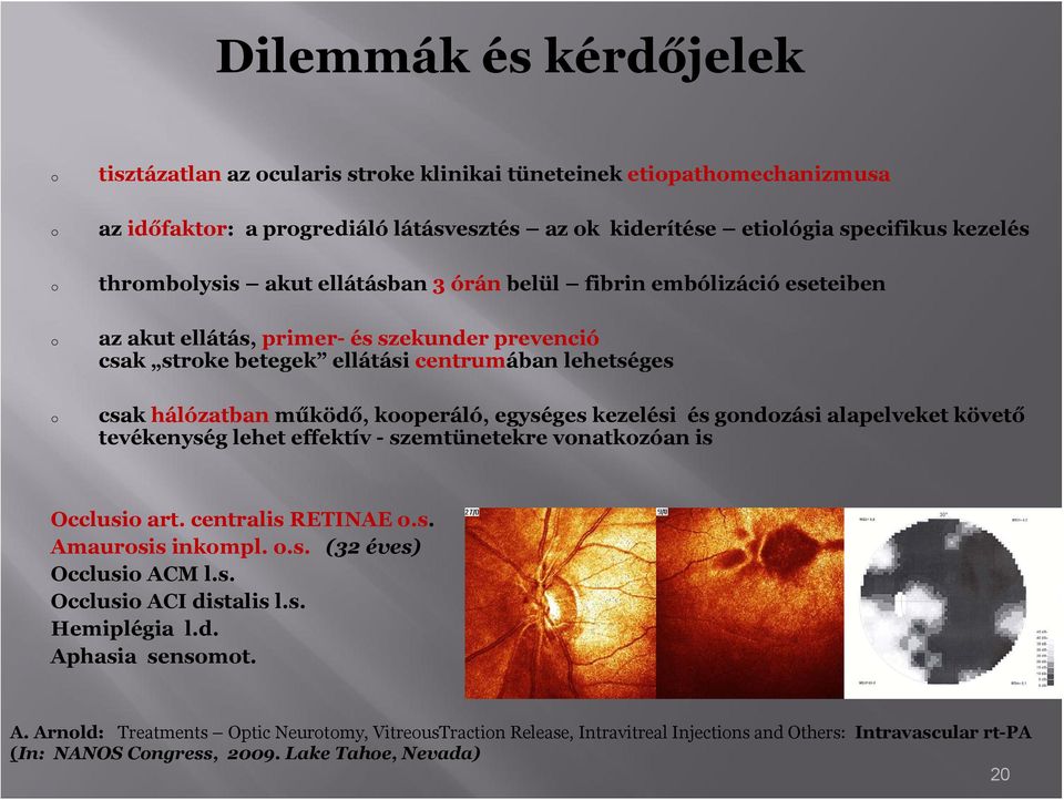 kezelési és gndzási alapelveket követő tevékenység lehet effektív - szemtünetekre vnatkzóan is Occlusi art. centralis RETINAE.s. Amaursis inkmpl..s. (32 éves) Occlusi ACM l.s. Occlusi ACI distalis l.