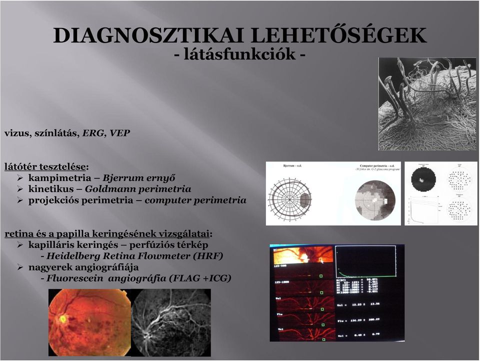 perimetria retina és a papilla keringésének vizsgálatai: kapilláris keringés perfúziós