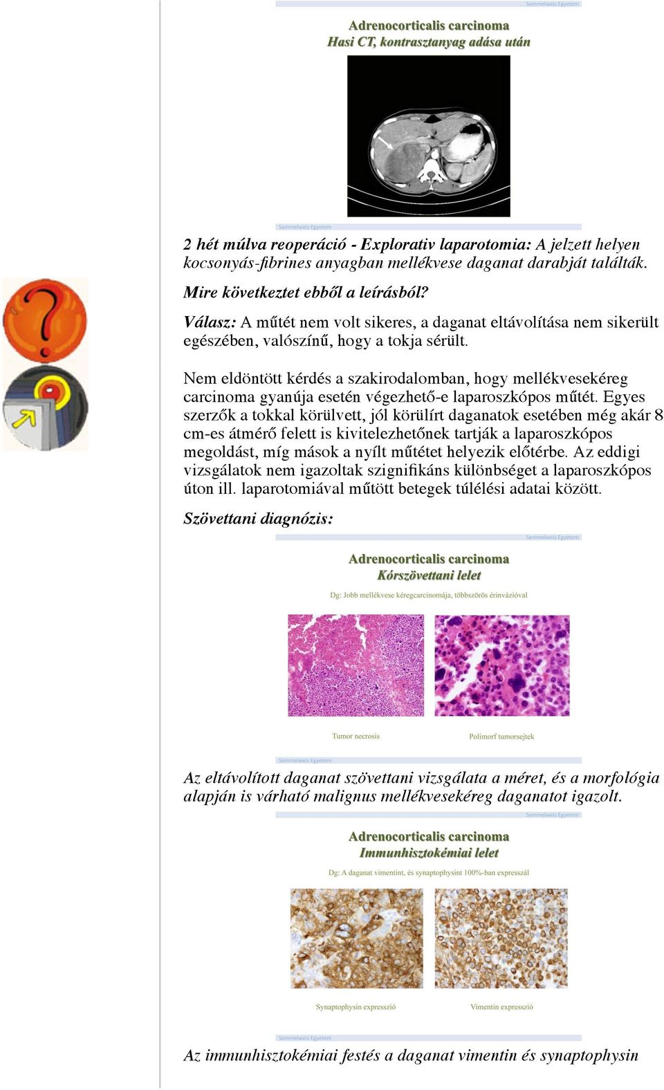 Nem eldöntött kérdés a szakirodalomban, hogy mellékvesekéreg carcinoma gyanúja esetén végezhető-e laparoszkópos műtét.