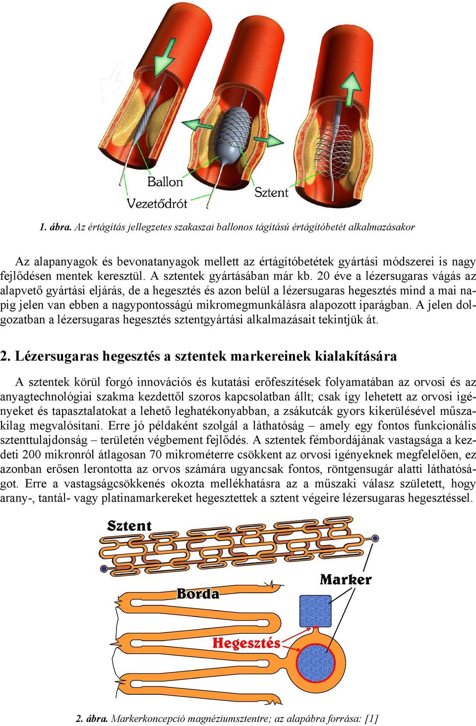 A sztentek gyártásában már kb.