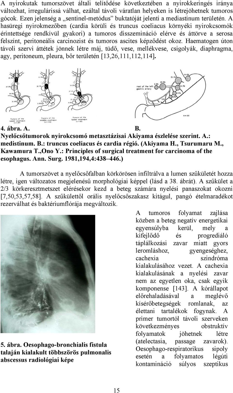 A hasüregi nyirokmezőben (cardia körüli és truncus coeliacus környéki nyirokcsomók érintettsége rendkívül gyakori) a tumoros disszemináció elérve és áttörve a serosa felszínt, peritoneális