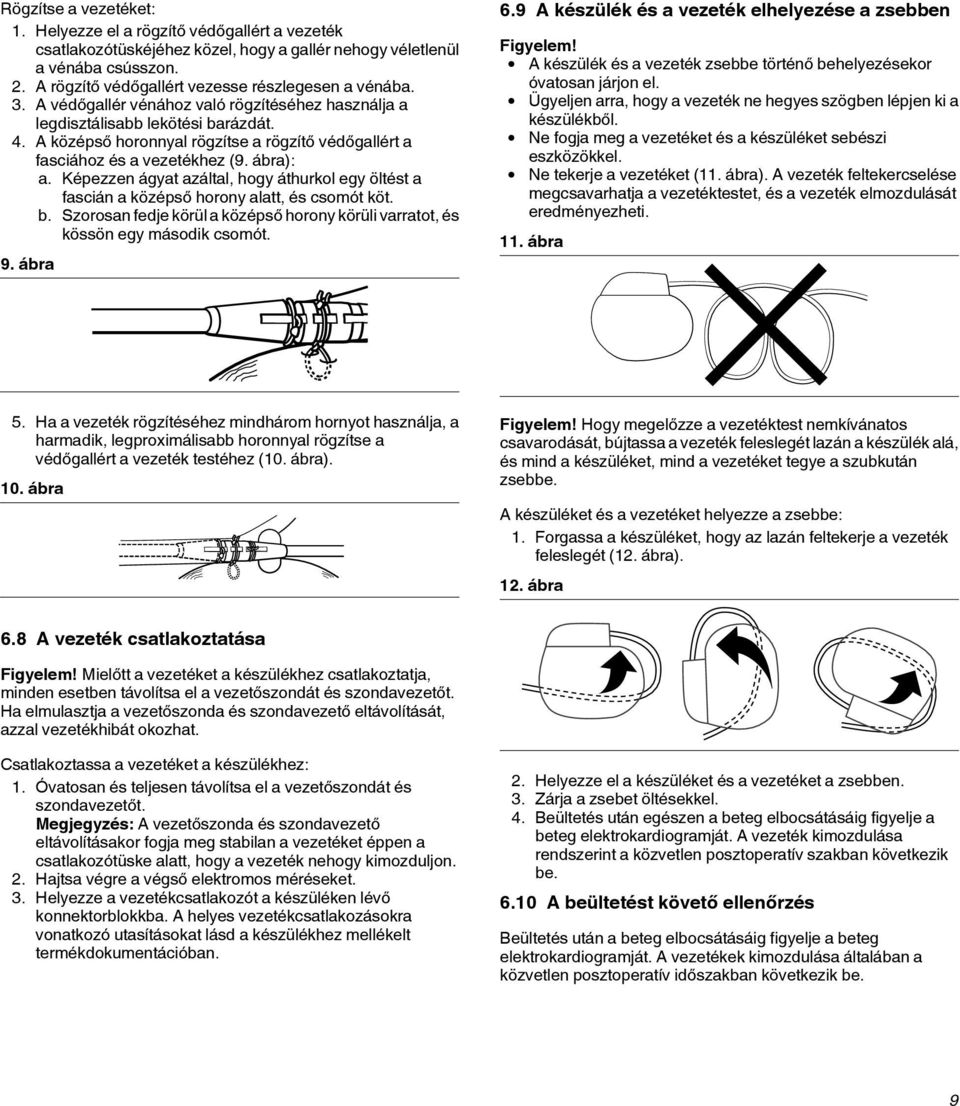 A középső horonnyal rögzítse a rögzítő védőgallért a fasciához és a vezetékhez (9. ábra): a. Képezzen ágyat azáltal, hogy áthurkol egy öltést a fascián a középső horony alatt, és csomót köt. b.