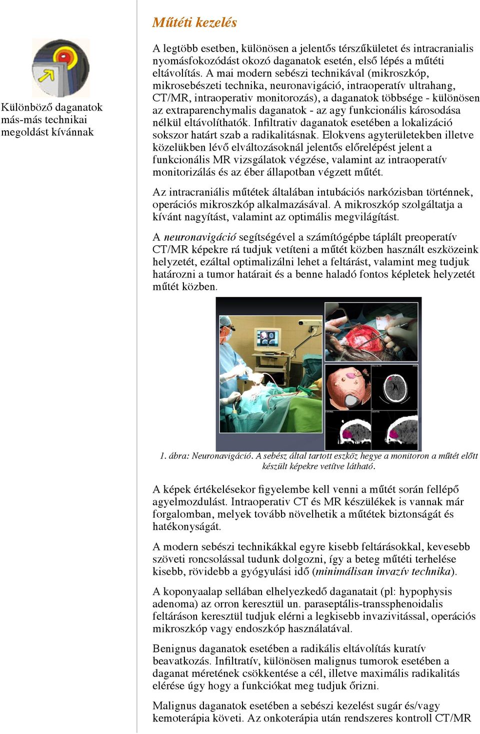 A mai modern sebészi technikával (mikroszkóp, mikrosebészeti technika, neuronavigáció, intraoperatív ultrahang, CT/MR, intraoperativ monitorozás), a daganatok többsége - különösen az