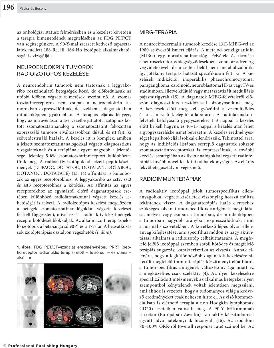 NEUROENDOKRIN TUMOROK RADIOIZOTÓPOS KEZELÉSE A neuroendokrin tumorok nem tartoznak a leggyakoribb rosszindulatú betegségek közé, de előfordulásuk az utóbbi időben végzett felmérések szerint nő.