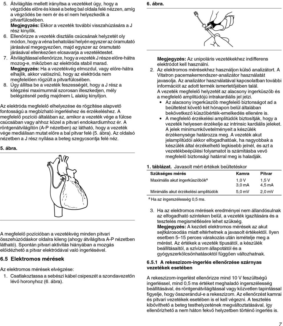 Ellenőrizze a vezeték disztális csúcsának helyzetét oly módon, hogy a véna behatolási helyén egyszer az óramutató járásával megegyezően, majd egyszer az óramutató járásával ellenkezően elcsavarja a